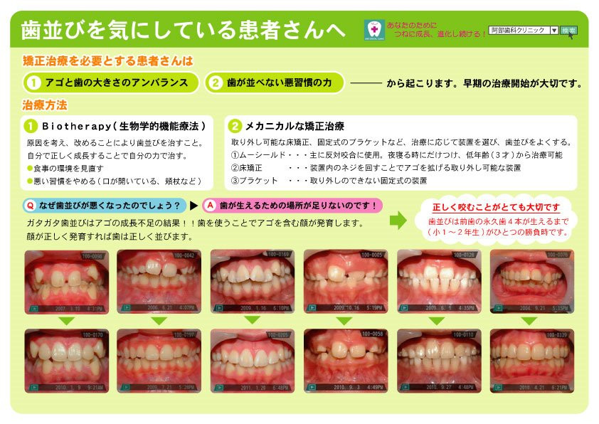 歯並びを気にしている患者さんへ