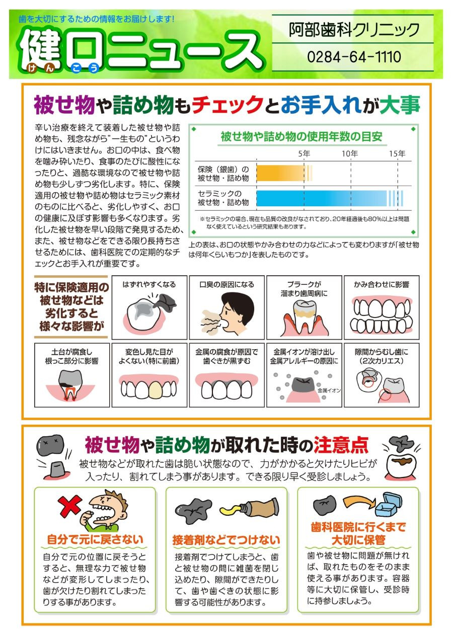 健口ニュース　 被せ物や詰め物もチェックとお手入れが大事