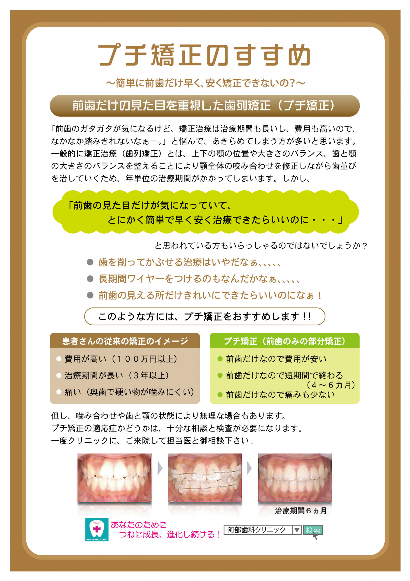 プチ矯正のすすめ