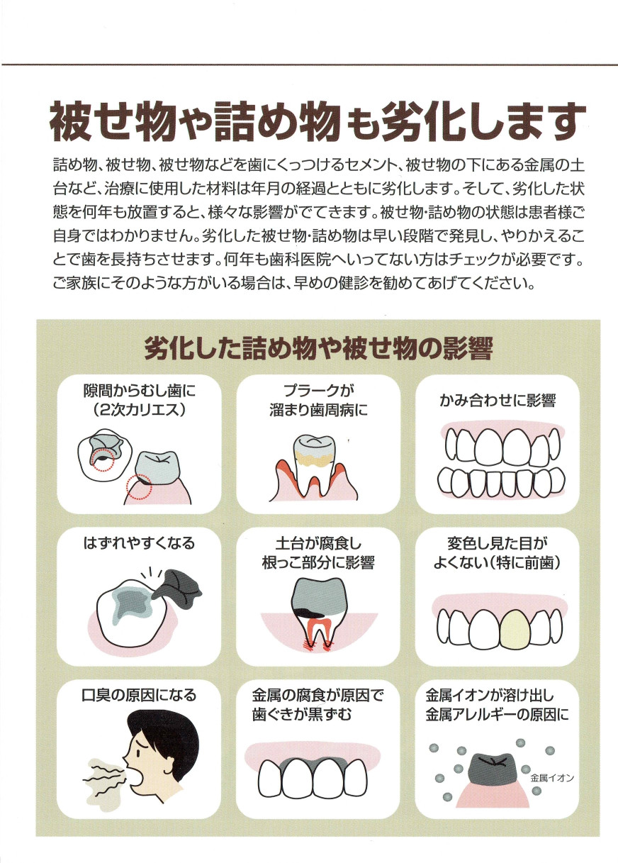 被せ物や詰め物も劣化します 