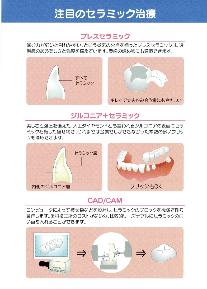 注目のセラミック治療